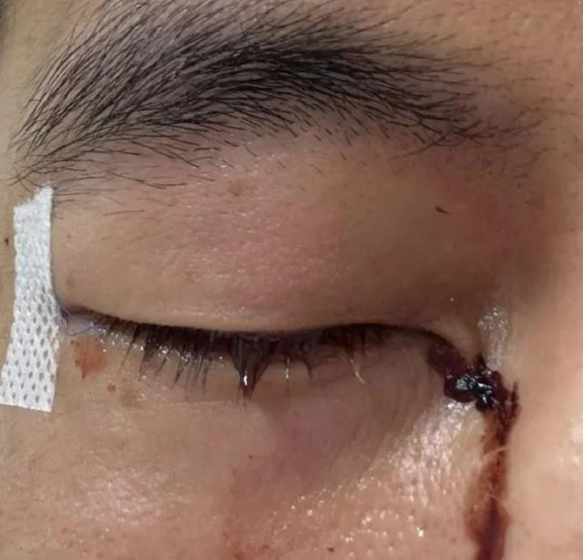 澳客注册-比赛期间突发意外，球员受伤情况引关注的简单介绍
